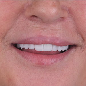 E-diş esenler,     Diş Tedavisi,Diş Estetiği,Diş Beyazlatma,     Ağız ve Diş Sağlığı,     Diş İmplantı,     Porselen Lamina,     Diş Protezi,     Çocuk Diş Hekimi,     Diş Ağrısı Tedavisi,     Gülüş Tasarımı,     Diş Temizliği,     Periodontal Tedavi,     Diş Eti Hastalıkları,     Diş Fırçalama Teknikleri,     Köprü Protez Tedavisi,     Kanal Tedavisi,     Diş Hekimi Randevusu,     Diş Beyazlatma Fiyatları,     Ağız Kokusu Nedenleri,     Diş Çürümesi Tedavisi,     Diş Hekimi İstanbul,     Diş Hekimi Danışmanlığı,     Ağız Hijyeni Önerileri